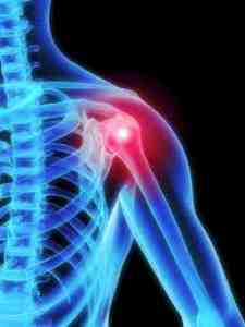 Picture depicting pain in the shoulder