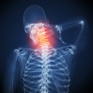 Illustration of neck pain