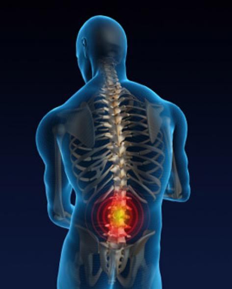 Illustration of lower back pain