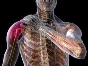 Illustration of shoulder pain