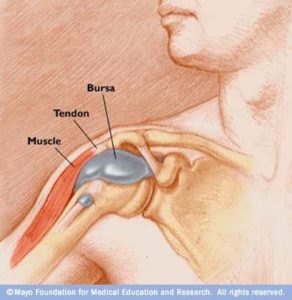 Picture of the anatomy of shoulder bursitis