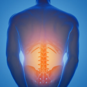 Picture of low back pain
